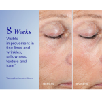 iS Clinical Active Peel System | iS Clinical Türkiye