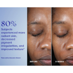 iS Clinical Active Peel System | iS Clinical Türkiye